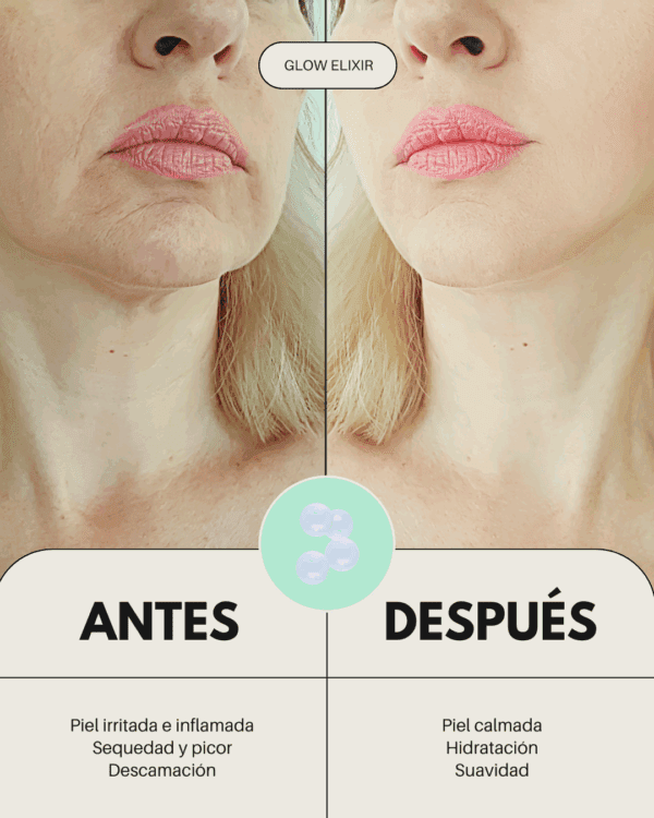 Marca: BANBU. Imagen: Aceite_facial_glow_elixir_antes_y_despues.png. Sérum Aceite Facial ECO Iluminador GLOW ELIXIR