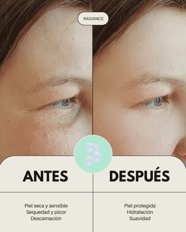 Marca: BANBU. Imagen: Balsamo_limpiador_radiance_antes_y_despus.png. Bálsamo limpiador facial en crema RADIANCE. 50ml