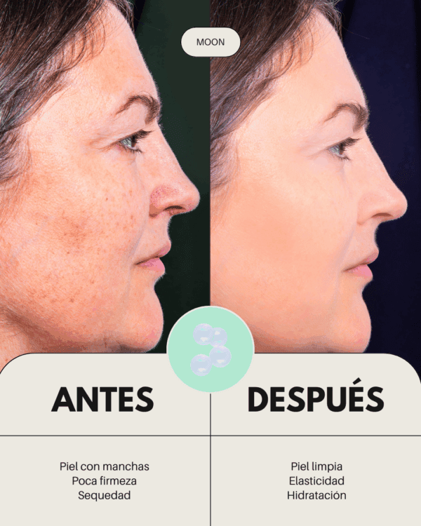 Marca: BANBU. Imagen: Crema_facial_Moon_antes_y_despues.png. Crema Facial ECO Nutritiva Well Aging MOON. 50ml.