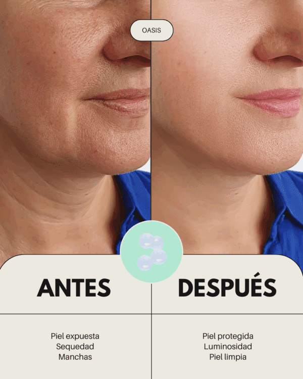 Marca: BANBU. Imagen: Pack_mini_tallas_piel_seca_antes_y_despu_s.png. Pack Mini Tallas ECO - Basic Essential Facial PIEL NORMAL Y SECA