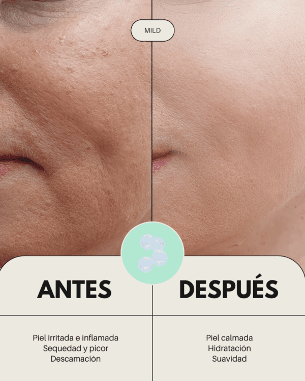 Marca: BANBU. Imagen: Pack_mini_tallas_piel_sensible_antes_y_despu_s.png. Pack Mini Tallas ECO - Basic Essential Facial PIEL SENSIBLE