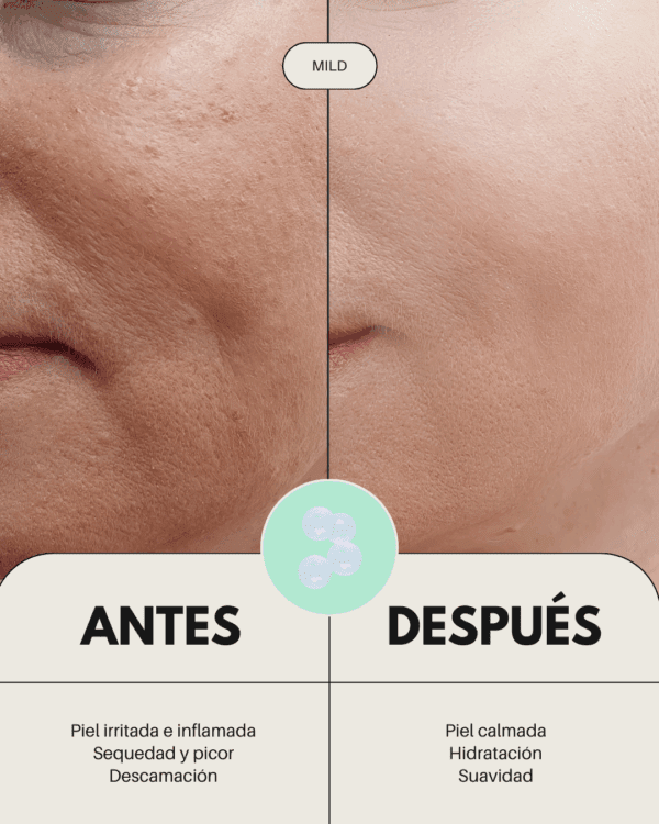 Marca: BANBU. Imagen: pack_rutina_facial_basico_antes_y_despues.png. Pack Rutina Facial BÁSICA ECO - PIEL SENSIBLE