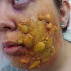 Marca: HARPO H.R.P.. Imagen: molde-cuatro.jpg. Molde 4