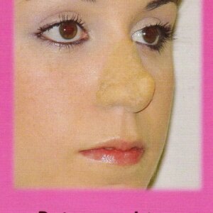 Marca: HARPO H.R.P.. Imagen: nariz-de-elfo.jpg. Nariz de elfo