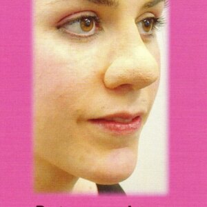 Marca: HARPO H.R.P.. Imagen: nariz-normal-redonda.jpg. Nariz normal redonda