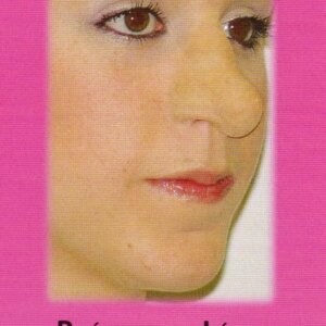 Marca: HARPO H.R.P.. Imagen: nariz-punta-redonda.jpg. Nariz punta redonda