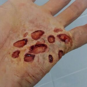 Marca: HARPO H.R.P.. Imagen: pustulas.jpg. Pústulas